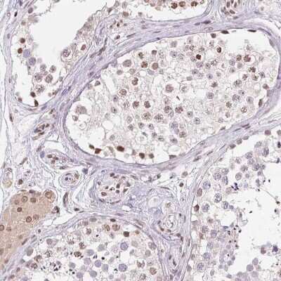 Immunohistochemistry-Paraffin: SMIM12 Antibody [NBP2-38066]