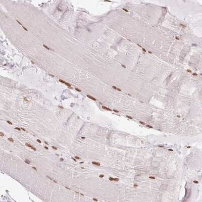Immunohistochemistry-Paraffin: SMIM12 Antibody [NBP2-38066]