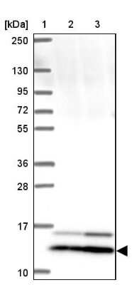 Western Blot: SMIM12 Antibody [NBP2-38066]