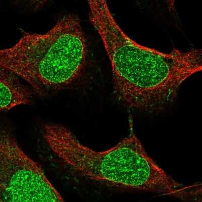 Immunocytochemistry/ Immunofluorescence: SMIM13 Antibody [NBP2-38074]