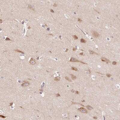 Immunohistochemistry-Paraffin: SMIM13 Antibody [NBP2-38074]