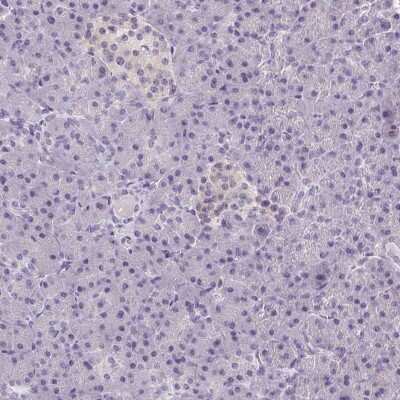 Immunohistochemistry-Paraffin: SMIM13 Antibody [NBP2-38074]