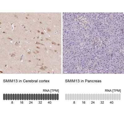 Immunohistochemistry-Paraffin: SMIM13 Antibody [NBP2-38074]