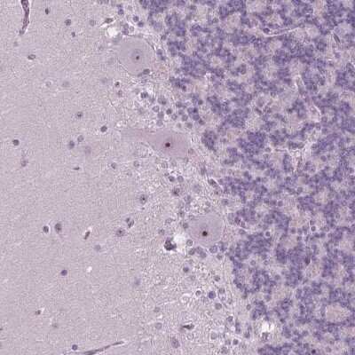 Immunohistochemistry: SMIM18 Antibody [NBP2-38091]