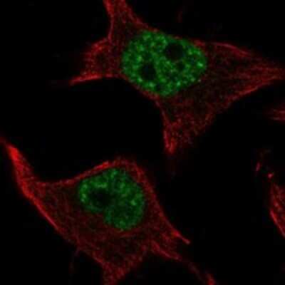 Immunocytochemistry/ Immunofluorescence: SMIM19 Antibody [NBP3-17623]