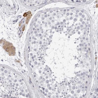 Immunohistochemistry-Paraffin: SMIM2 Antibody [NBP2-47269]