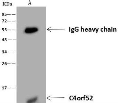 Immunoprecipitation: SMIM20 Antibody [NBP3-12670]