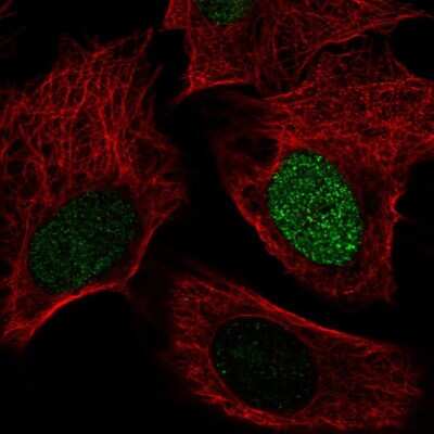 Immunocytochemistry/ Immunofluorescence: SMIM6 Antibody [NBP2-38076]