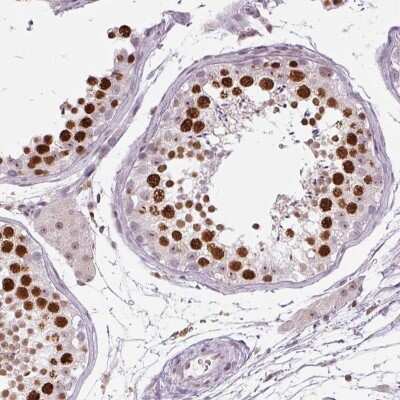 Immunohistochemistry-Paraffin: SMIM6 Antibody [NBP2-38076]
