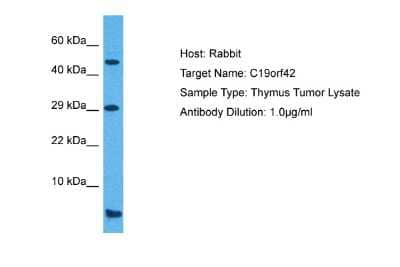 Western Blot: SMIM7 Antibody [NBP2-83565]