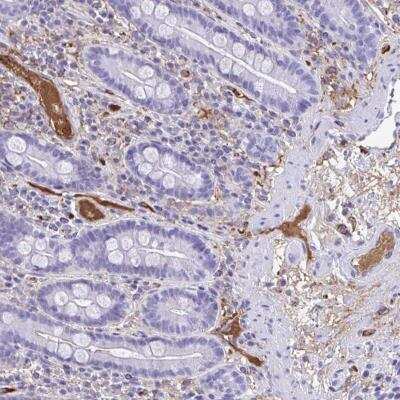 Immunohistochemistry-Paraffin: SMIM9 Antibody [NBP2-32578]