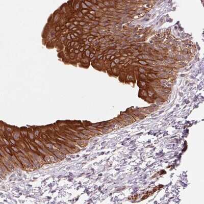 Immunohistochemistry-Paraffin: SMLR1 Antibody [NBP2-38085]