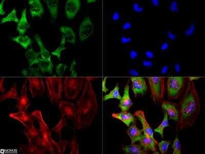 Immunocytochemistry/ Immunofluorescence: SMN Antibody (2B1) - Azide and BSA Free [NBP2-80955]