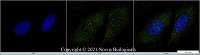 Immunocytochemistry/ Immunofluorescence: SMN Antibody (2B1) - Azide and BSA Free [NBP2-80955]
