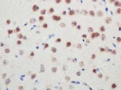 Immunohistochemistry: SMN Antibody (2B1) - Azide and BSA Free [NBP2-80955]