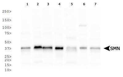 Western Blot: SMN Antibody (2B1)Azide and BSA Free [NBP2-80955]