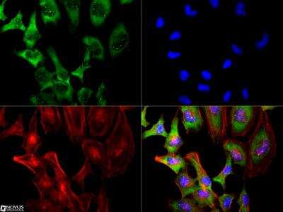 Immunocytochemistry/ Immunofluorescence: SMN Antibody (2B1) [NB100-1936]