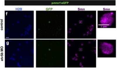 Immunocytochemistry/ Immunofluorescence: SMN Antibody (2B1) [NB100-1936]