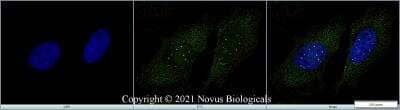Immunocytochemistry/ Immunofluorescence: SMN Antibody (2B1) [NB100-1936]