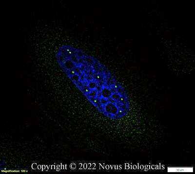 Immunocytochemistry/ Immunofluorescence: SMN Antibody (2B1) [NB100-1936]