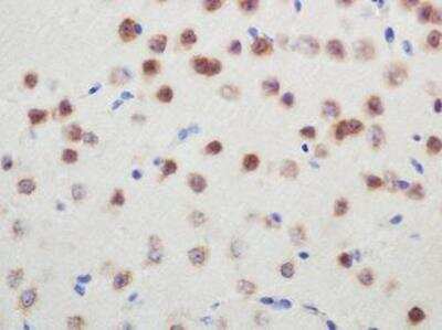 Immunohistochemistry: SMN Antibody (2B1) [NB100-1936]