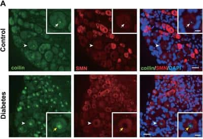 Immunohistochemistry: SMN Antibody (2B1) [NB100-1936]