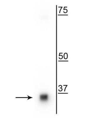 Western Blot: SMN Antibody (4B7) [NBP3-11944]