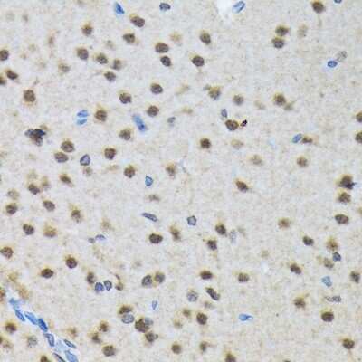 Immunohistochemistry-Paraffin: SMN Antibody (9N9Q6) [NBP3-16863]