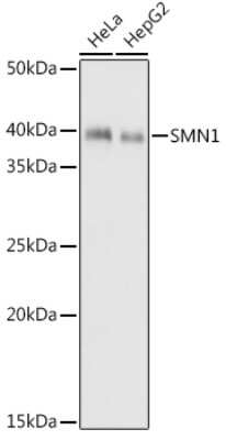 Western Blot: SMN Antibody (9N9Q6) [NBP3-16863]