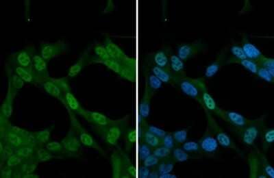 Immunocytochemistry/ Immunofluorescence: SMN Antibody [NBP3-13414]