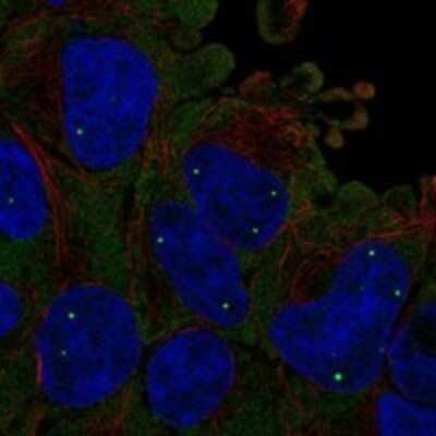 Immunocytochemistry/ Immunofluorescence: SMN Antibody [NBP3-17675]