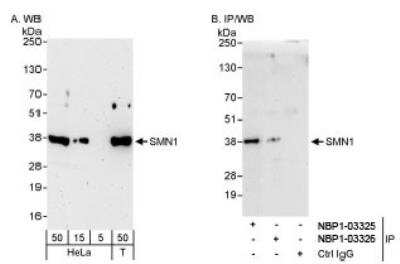 Western Blot: SMN Antibody [NBP1-03326]