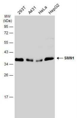 Western Blot: SMN Antibody [NBP1-32021]