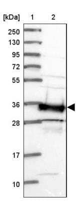 Western Blot: SMN Antibody [NBP2-46712]