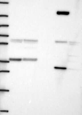 Western Blot: SMN Antibody [NBP3-17675]