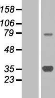 Western Blot: SMN Overexpression Lysate [NBP2-06396]