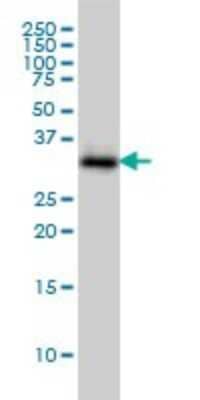 Western Blot: SMN2 Antibody (2B11-2A9) [H00006607-M01]