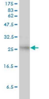 Western Blot: SMN2 Antibody (2B11-2A9) [H00006607-M01]