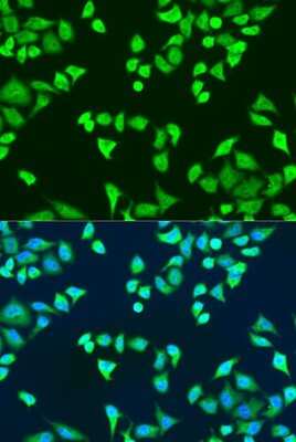Immunocytochemistry/ Immunofluorescence: SMN2 Antibody - BSA Free [NBP2-94130]