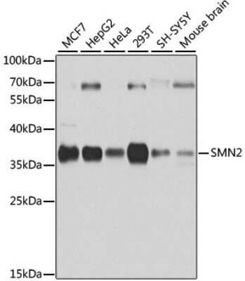 Western Blot: SMN2 AntibodyBSA Free [NBP2-94130]