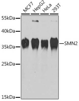 Western Blot: SMN2 AntibodyBSA Free [NBP2-94596]