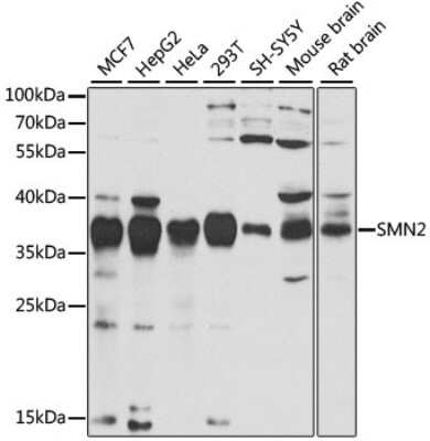 Western Blot: SMN2 AntibodyBSA Free [NBP2-95125]