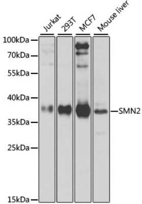 Western Blot: SMN2 AntibodyBSA Free [NBP2-95125]