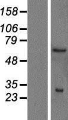 Western Blot: SMN2 Overexpression Lysate [NBP2-09908]