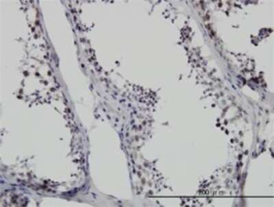 Immunohistochemistry-Paraffin: SMNDC1 Antibody (2B9) [H00010285-M01]