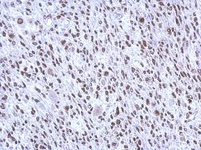 Immunohistochemistry-Paraffin: SMNDC1 Antibody [NBP2-20424]