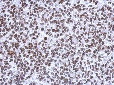 Immunohistochemistry-Paraffin: SMNDC1 Antibody [NBP2-20424]