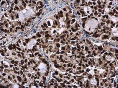 Immunohistochemistry-Paraffin: SMNDC1 Antibody [NBP2-20424]