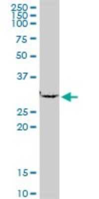 Western Blot: SMNDC1 Antibody [H00010285-B01P]