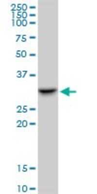 Western Blot: SMNDC1 Antibody [H00010285-B01P]